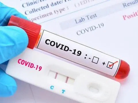 Bộ Y tế cấp phép 16 loại kit test nhanh kháng nguyên SARS-CoV-2